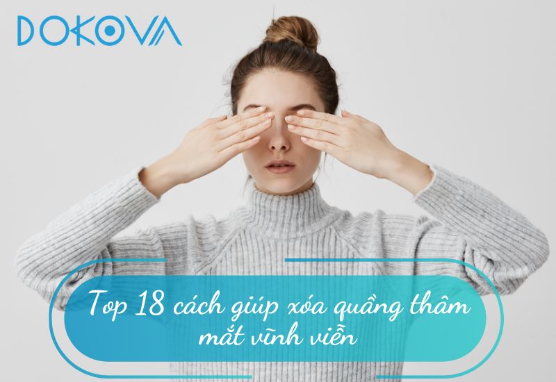 Top 18 cách giúp xóa quầng thâm mắt vĩnh viễn