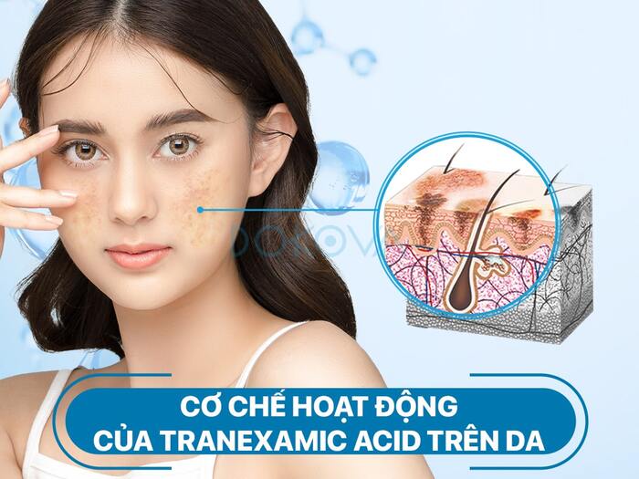 Cơ chế hoạt động của tranexamic acid trị nám trên da