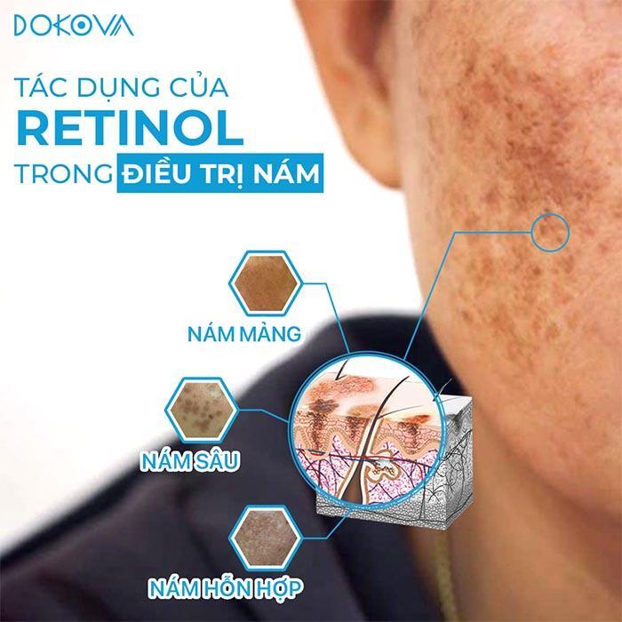 Tác dụng trị nám của retinol