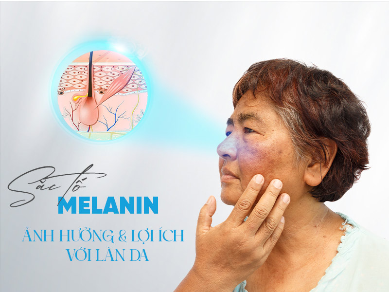 ảnh hưởng và lợi ích của sắc tố melanin lên da